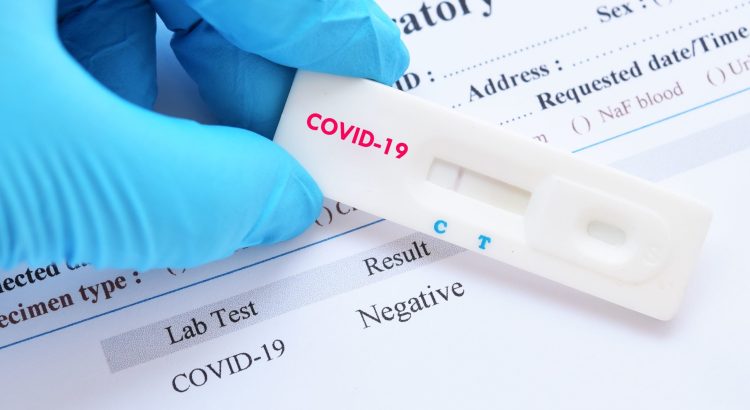 does cvs have rapid covid test kits