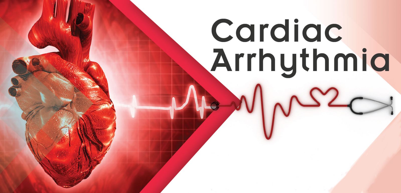 Research On Arrhythmia Could Reduce The Risk Of Sudden Cardiac Death