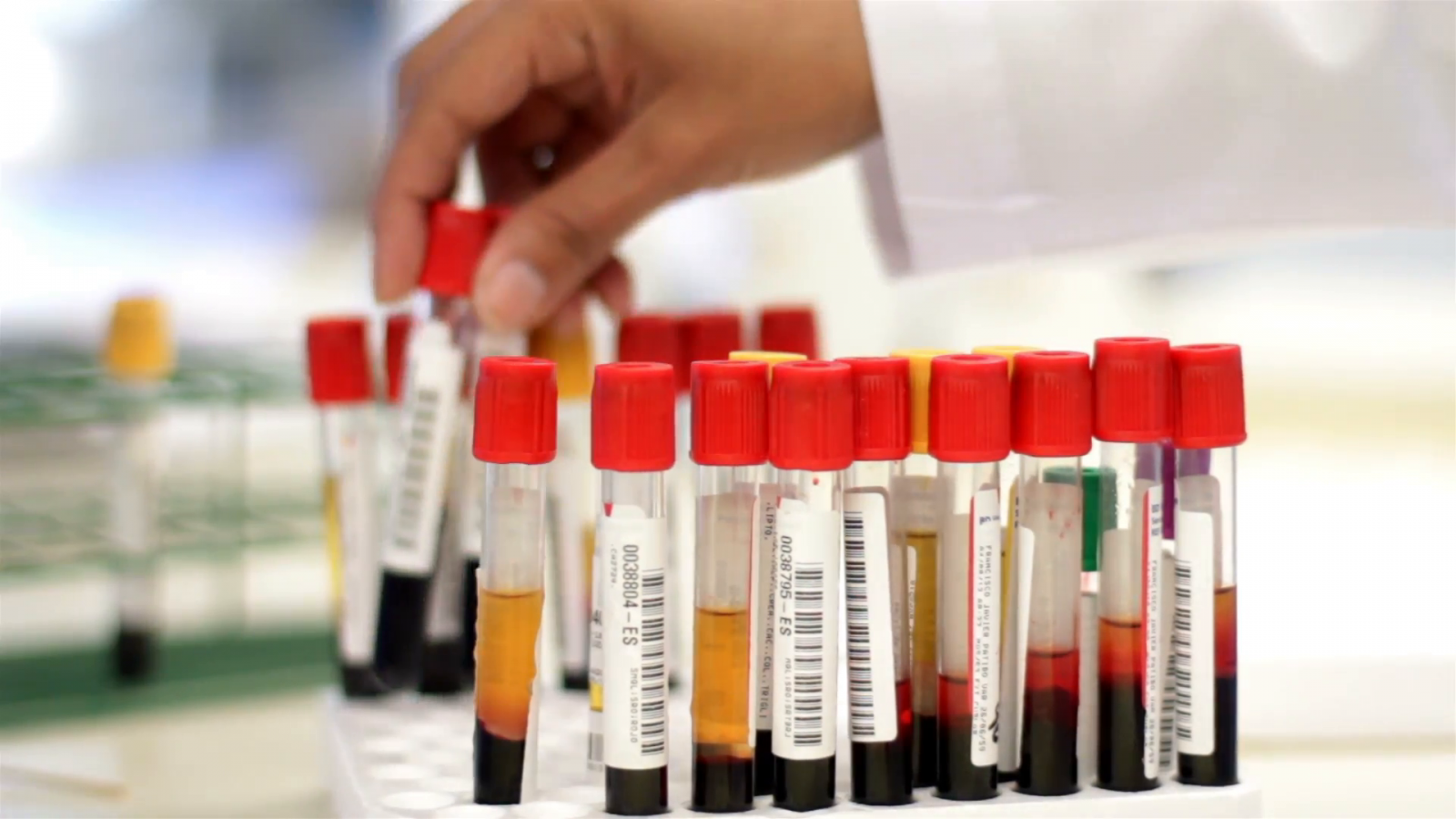 Blood test detects brain