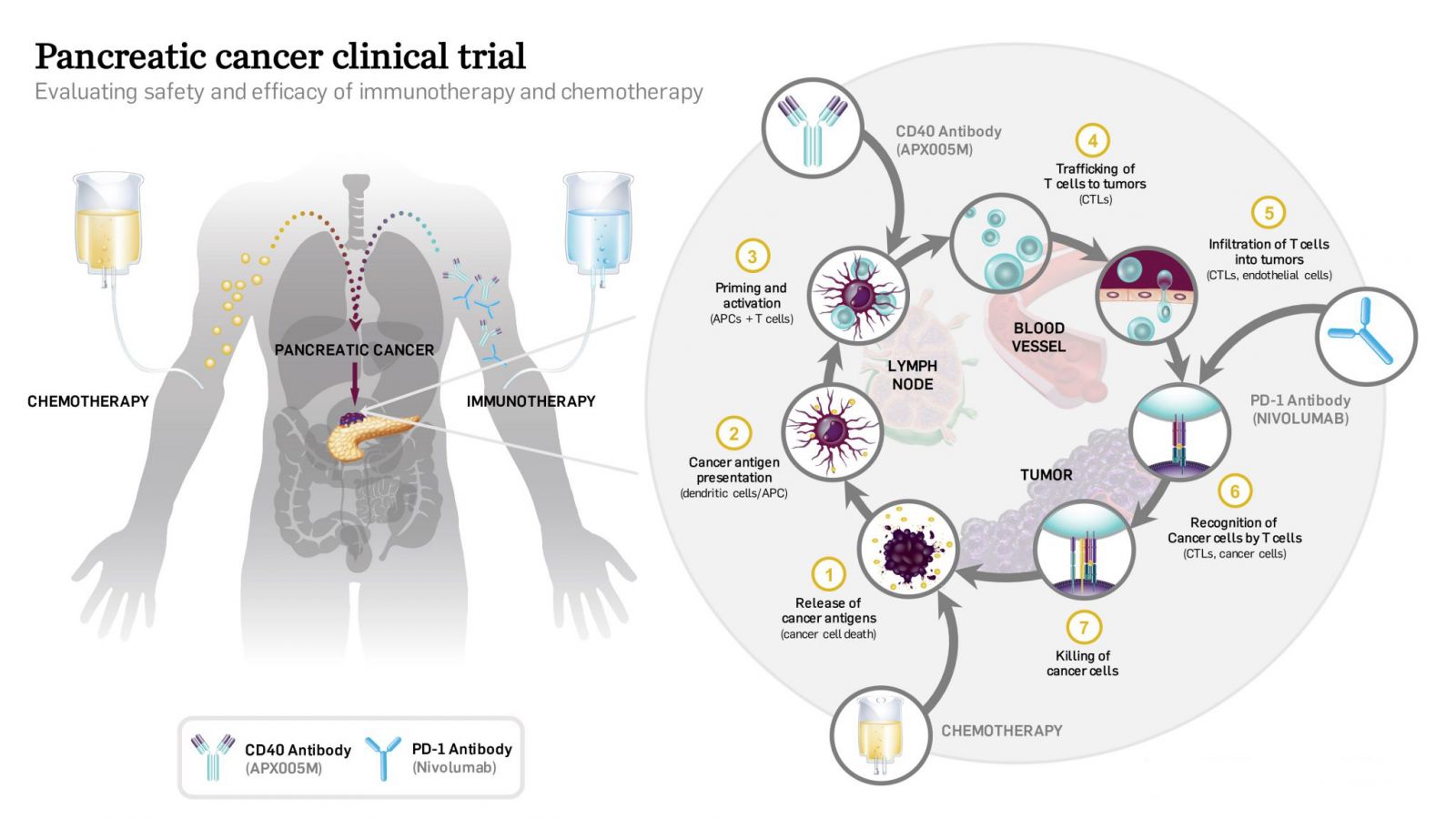 New Immunotherapy Target Identified In Treating Pancreatic Cancer