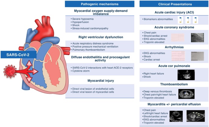 Major Study of Atherosclerotic Plaque Deposits Shows Potential Breakthrough  in Determining Risk for Heart Attacks