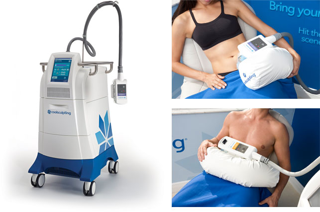CoolSculpting and SculpSure