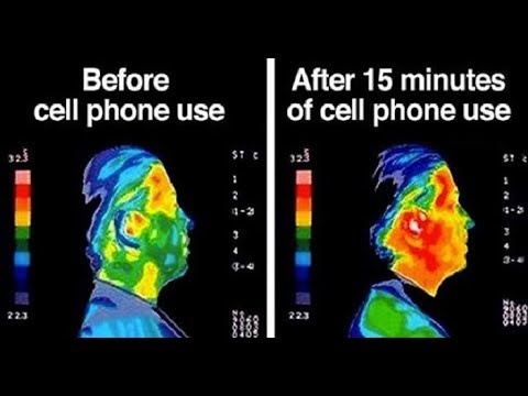 5G Consequences On Human Health - Thailand Medical News
