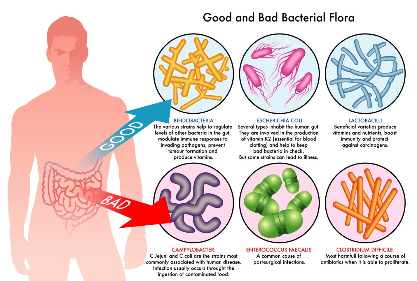 dysbiosis colon cancerul se ia