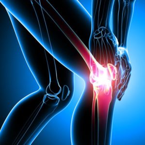 Earlier Detection of Osteoarthritis May Lead to Better Treatment Outcomes