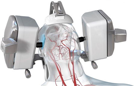 Flow Assessment