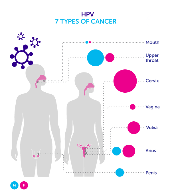 does bladder cancer cause strong smelling urine