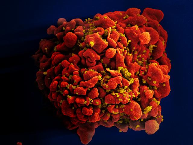 Hidden HIV can now be accurately measured