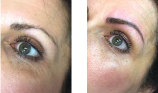 MICROBLADING