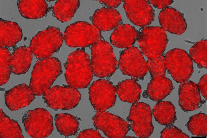 New Stem Cell Therapy To Treat Diabetes