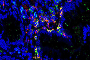 Researchers discover a type of cell which induces acute inflammatory episodes in bowel diseases