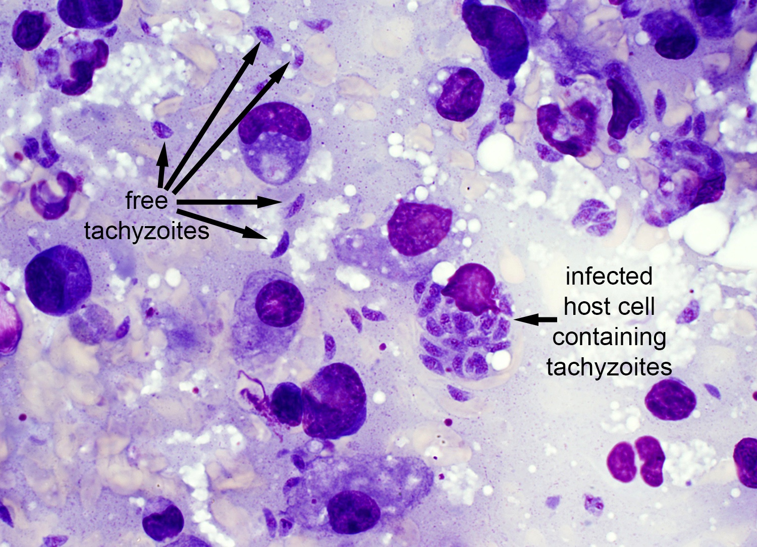 toxoplasma gondia)