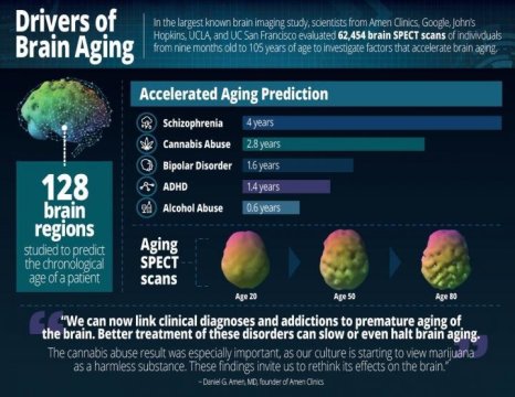 brain aging