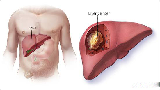 common liver