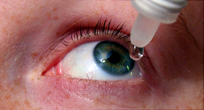 Dry Eye Syndrome: Symptoms, Causes and Treatments.