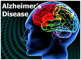 help fight Alzheimer