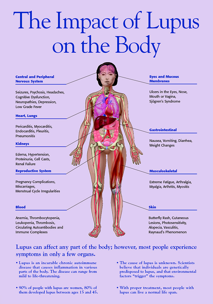 Newer, Faster And Efficient System For Lupus Detection