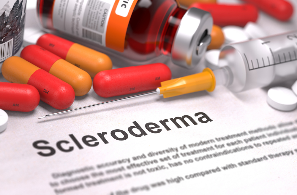 scleroderma fibrosis