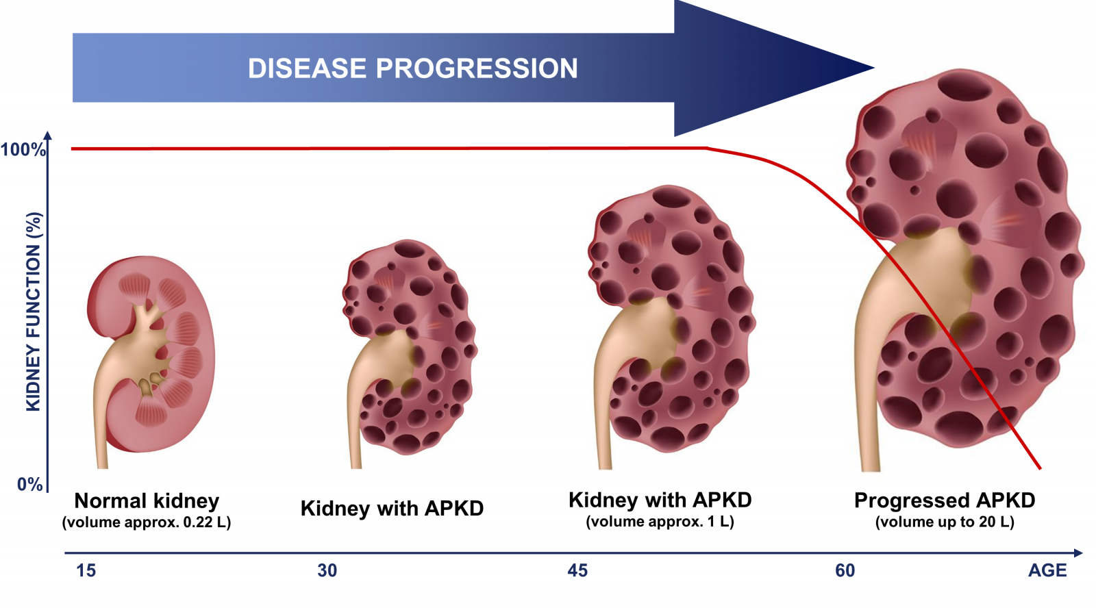 study-shows-polycystic