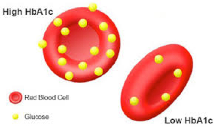 type 2 diabetes