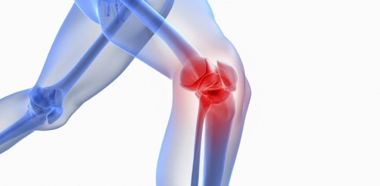 women against knee osteoarthritis