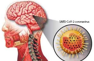 Breaking News! Coronavirus Can Also Attack The Nervous System ...
